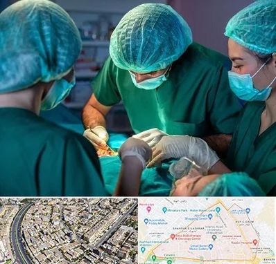 عمل کوچک کردن سینه در شهرک غرب مشهد