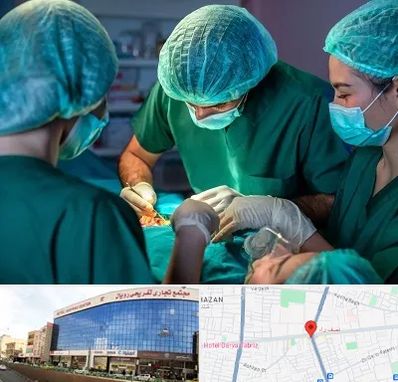 عمل کوچک کردن سینه در نصف راه تبریز