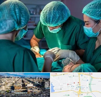 عمل کوچک کردن سینه در شهرک راه آهن