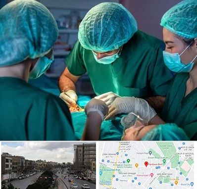 عمل کوچک کردن سینه در بلوار فردوسی مشهد