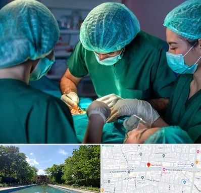 عمل کوچک کردن سینه در هشت بهشت اصفهان