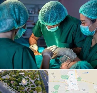 عمل کوچک کردن سینه در کاشمر