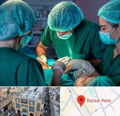 عمل کوچک کردن سینه در بازار رضا مشهد