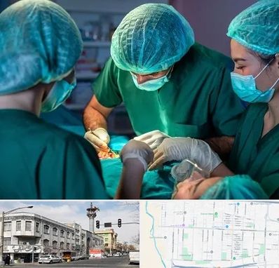 عمل کوچک کردن سینه در 17شهریور