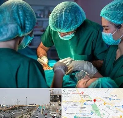 عمل کوچک کردن سینه در بلوار توس مشهد