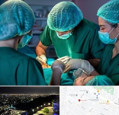 عمل کوچک کردن سینه در هفت تیر مشهد