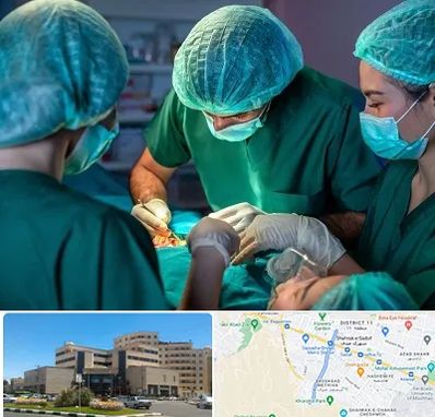 عمل کوچک کردن سینه در صیاد شیرازی مشهد