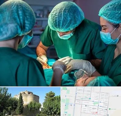 عمل کوچک کردن سینه در مرداویج اصفهان