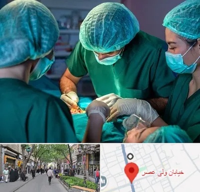 عمل کوچک کردن سینه در ولیعصر شهریار