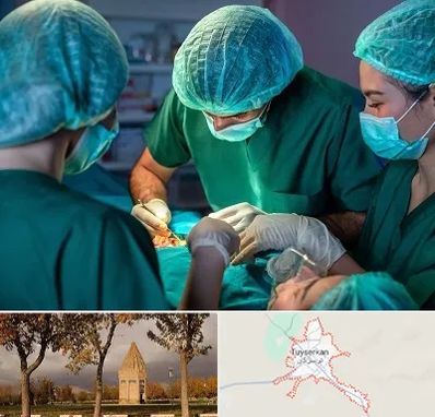 عمل کوچک کردن سینه در تویسرکان