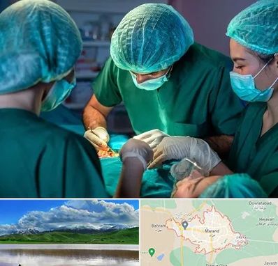 عمل کوچک کردن سینه در مرند