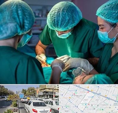 عمل کوچک کردن سینه در مفتح مشهد