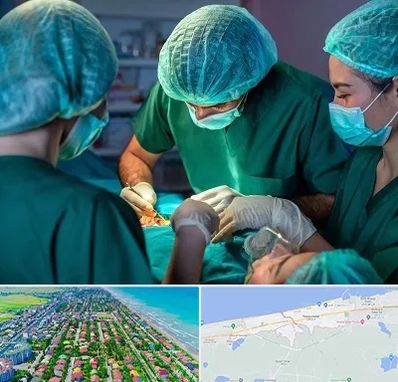 عمل کوچک کردن سینه در فریدونکنار