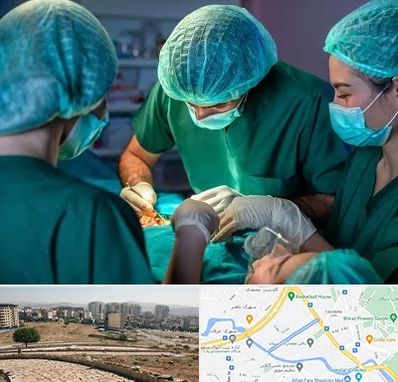 عمل کوچک کردن سینه در کوی وحدت شیراز