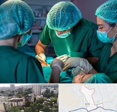 عمل کوچک کردن سینه در اوین