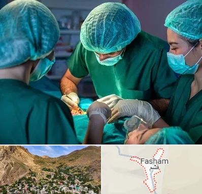 عمل کوچک کردن سینه در فشم