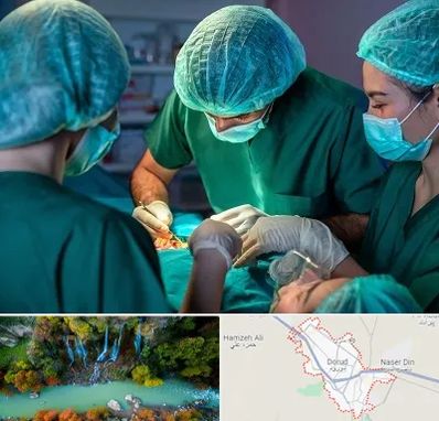 عمل کوچک کردن سینه در دورود