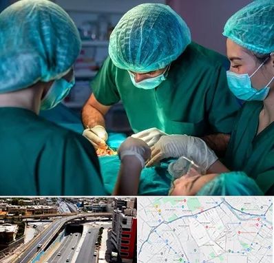 عمل کوچک کردن سینه در ستارخان شیراز