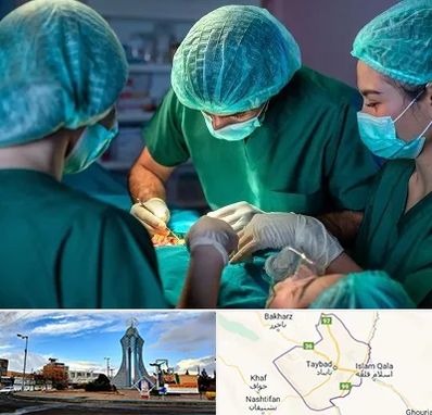 عمل کوچک کردن سینه در تایباد