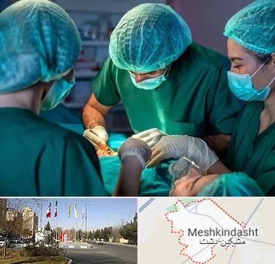 عمل کوچک کردن سینه در مشکین دشت