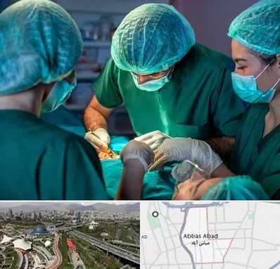 عمل کوچک کردن سینه در عباس آباد تهران