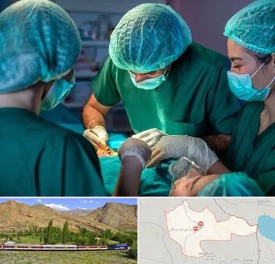 عمل کوچک کردن سینه در خاش