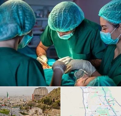 عمل کوچک کردن سینه در فرهنگ شهر شیراز