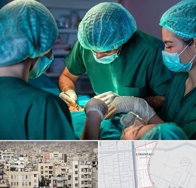 عمل کوچک کردن سینه در اسکندری