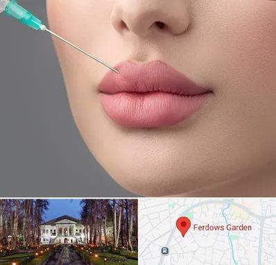 کلینیک ژل لب روسی در باغ فردوس