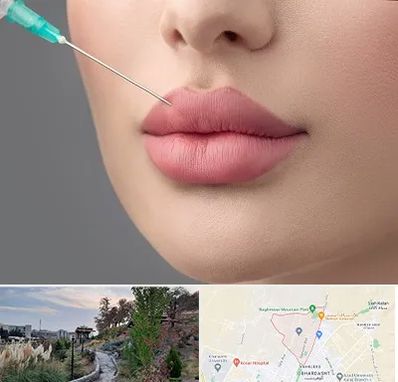 کلینیک ژل لب روسی در باغستان کرج