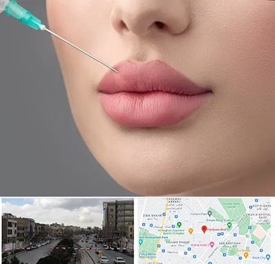 کلینیک ژل لب روسی در بلوار فردوسی مشهد