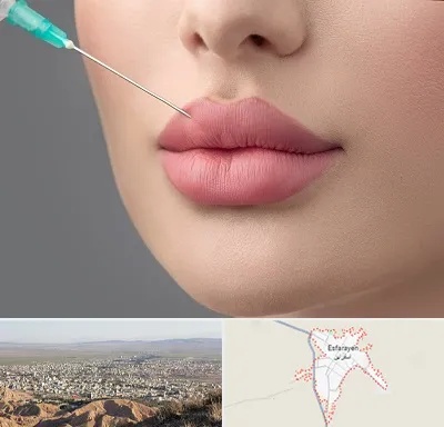 کلینیک ژل لب روسی در اسفراین
