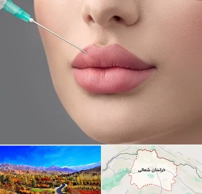 کلینیک ژل لب روسی در خراسان شمالی
