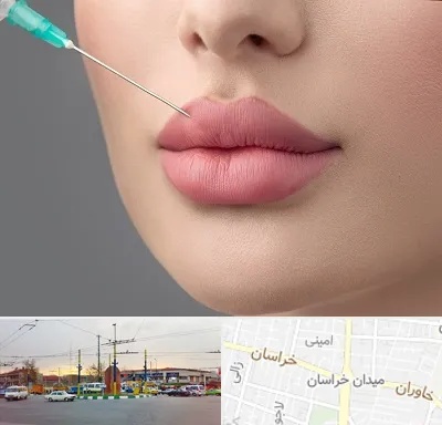 کلینیک ژل لب روسی در میدان خراسان