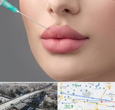 کلینیک ژل لب روسی در فرجام