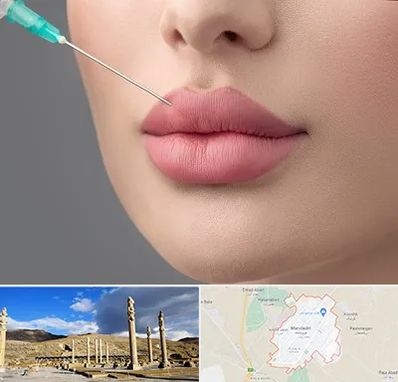 کلینیک ژل لب روسی در مرودشت