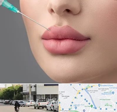 کلینیک ژل لب روسی در قدوسی شرقی شیراز