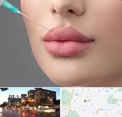 کلینیک ژل لب روسی در بلوار سجاد مشهد