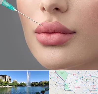 کلینیک ژل لب روسی در کوهسنگی مشهد