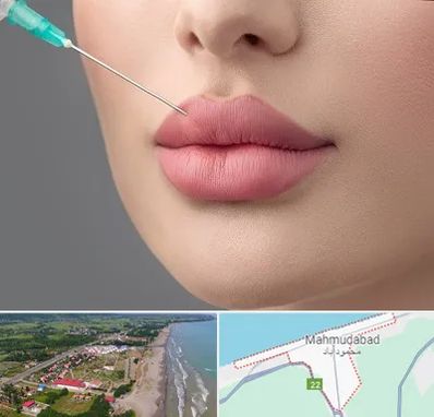 کلینیک ژل لب روسی در محمودآباد