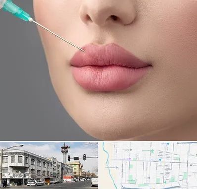 کلینیک ژل لب روسی در 17شهریور