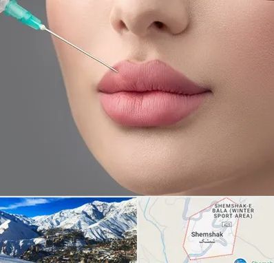 کلینیک ژل لب روسی در شمشک