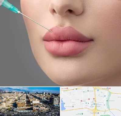 کلینیک ژل لب روسی در شهرک راه آهن