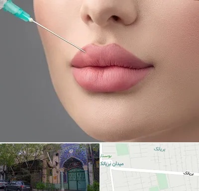 کلینیک ژل لب روسی در بریانک
