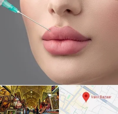 کلینیک ژل لب روسی در بازار وکیل شیراز