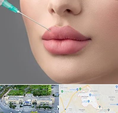 کلینیک ژل لب روسی در نسیم شهر