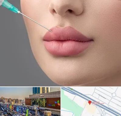 کلینیک ژل لب روسی در لاله پارک تبریز