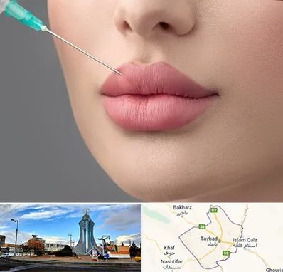 کلینیک ژل لب روسی در تایباد