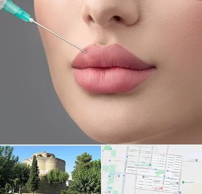 کلینیک ژل لب روسی در مرداویج اصفهان