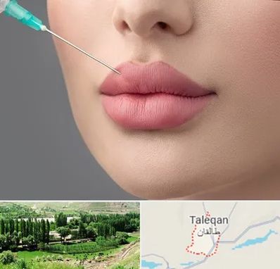 کلینیک ژل لب روسی در طالقان